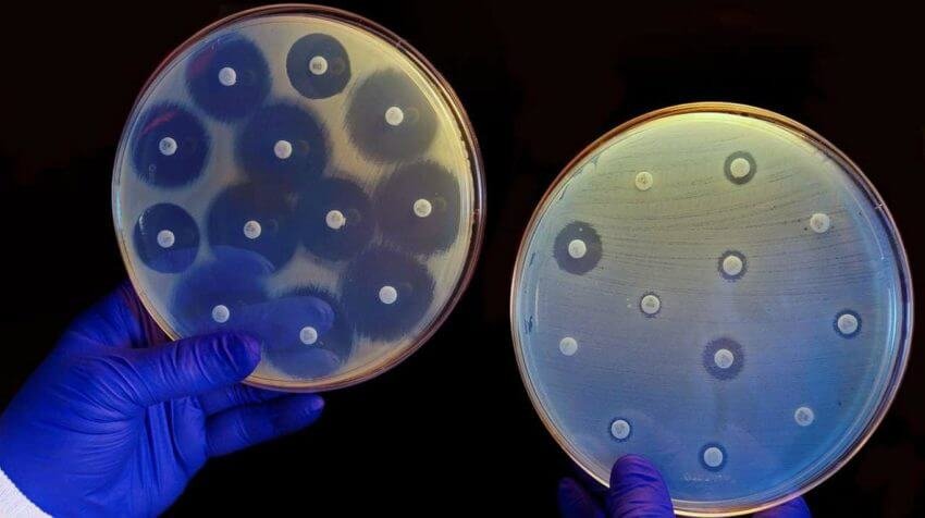 Anti-Bacterial-or-Bactericidal-Test